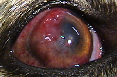 Ocular Pannus